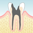 一般歯科（虫歯）